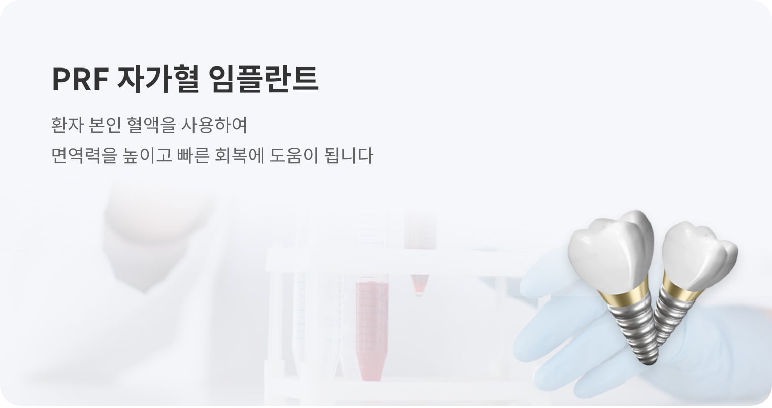 PRF 자가혈 임플란트